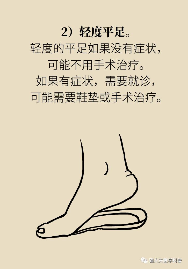 走几百米就痛得不行，这样的平脚板怎么治？