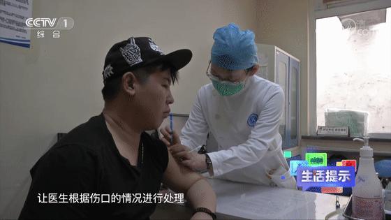 被动物咬伤或抓伤处理方法及顺序,动物抓伤咬伤