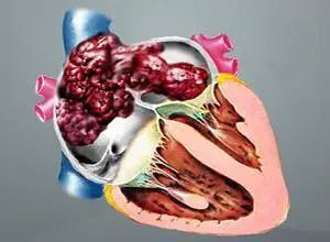 世界心脏日视频,世界心脏日是什么意思