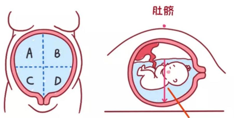 关于羊水的所有干货，一篇给你讲清楚