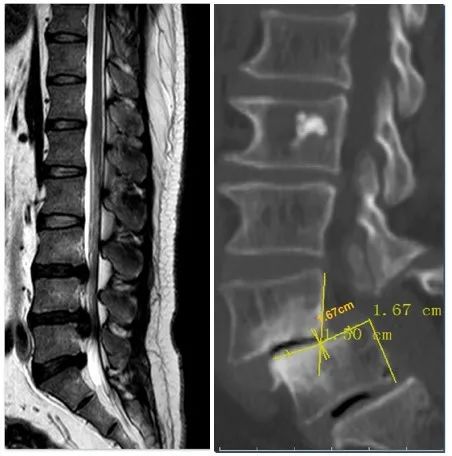 筋骨堂治疗视频,筋骨堂治疗效果怎么样