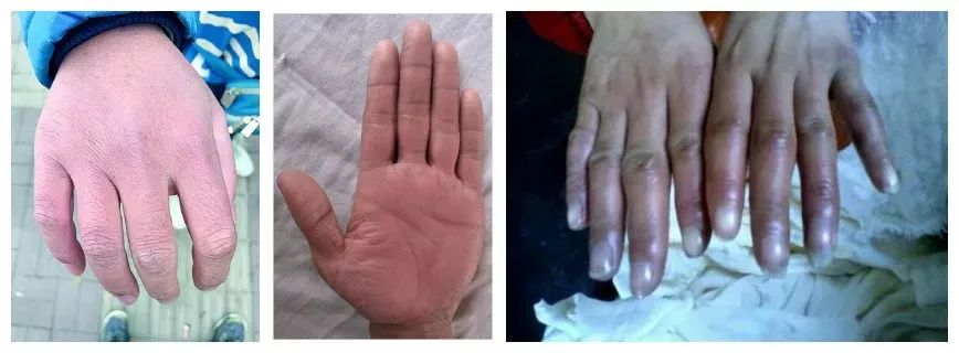 冬季干性皮肤擦的护手霜,适合秋天用的护手霜