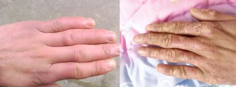 冬季干性皮肤擦的护手霜,适合秋天用的护手霜