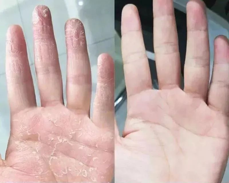 冬季干性皮肤擦的护手霜,适合秋天用的护手霜