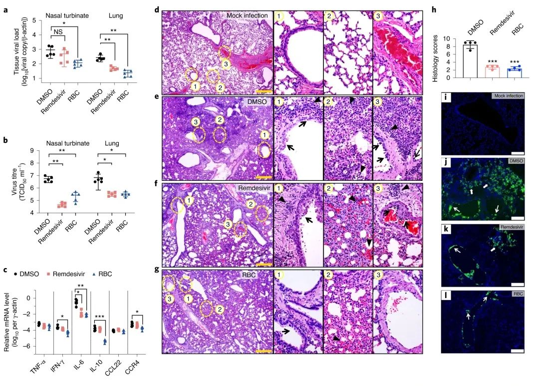 「Nature子刊」比瑞德西韦便宜，比地塞米松安全！香港大学发现一种胃溃疡药物可成功治疗新冠肺炎