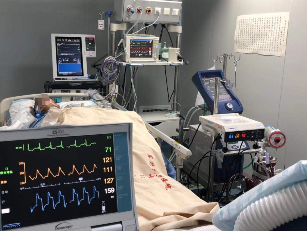 东莞这些医院有ECMO!被神化的利器背后,考量医院综合实力!