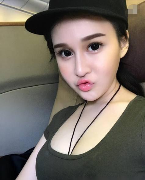 赵本山女儿整容成功了吗,赵本山女儿整容几次