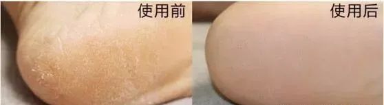 莉碧儿山羊奶滋养护手膜用法,莉碧儿水润保湿面膜怎么样