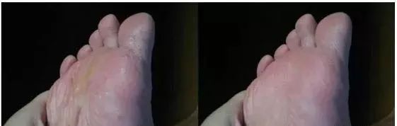 莉碧儿山羊奶滋养护手膜用法,莉碧儿水润保湿面膜怎么样