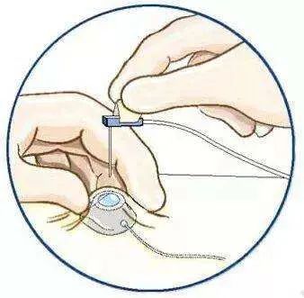 全是干货！乳腺癌病友常见的十个问答汇总