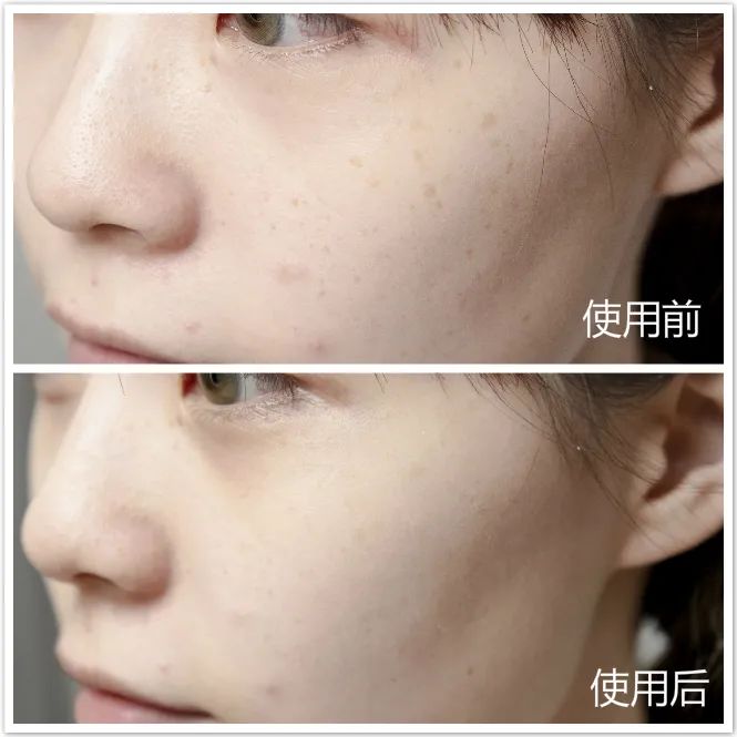 祛过斑用什么护肤品好,什么斑不能用护肤品去掉