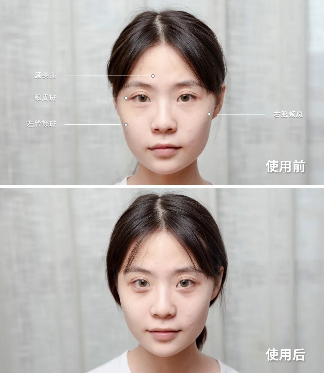 祛过斑用什么护肤品好,什么斑不能用护肤品去掉