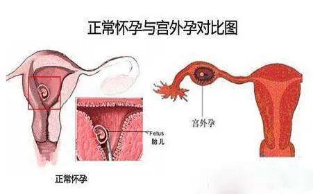 被遗忘的女人沉默杀手完整版,被遗忘的杀手