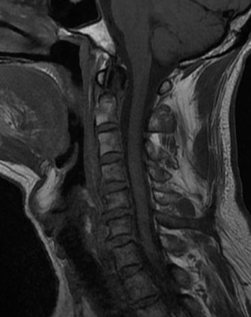 北京友谊医院微创外科,北京友谊医院骨科微创手术
