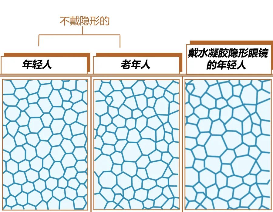 隐形眼镜买不买合适,隐形眼镜和角膜镜哪个伤害大