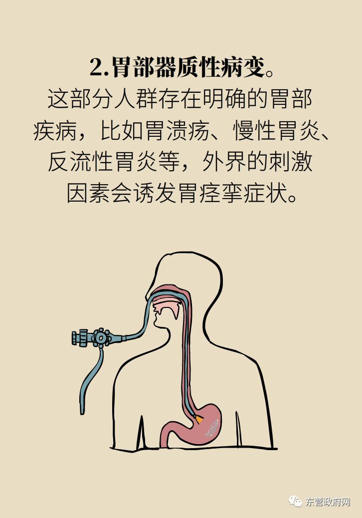 胃痉挛最有效的解决办法,胃痉挛怎么能缓解一下