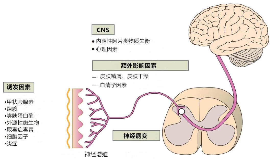 糖尿病肾病引起皮肤瘙痒怎么办,肾病导致的瘙痒