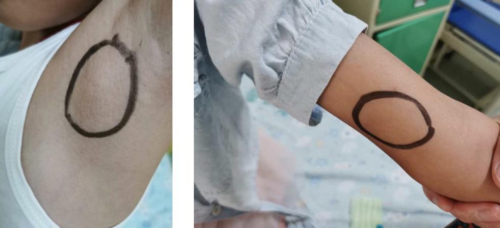 撸猫得怪病,儿童撸猫得病