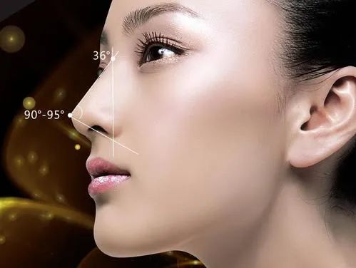 玻尿酸怎么植物提取的,怎样打玻尿酸更有少女感