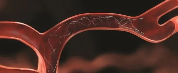 世界脑卒中日活动流程,世界卒中日警惕症状尽早识别救治