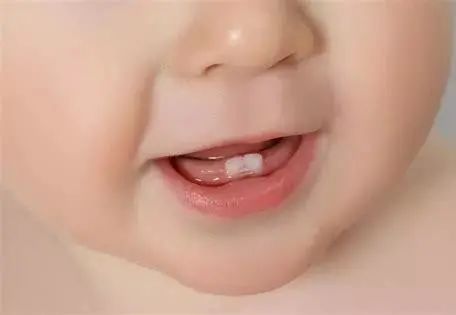 天天刷牙怎么还得龋齿,小孩天天刷牙怎么会蛀牙啊