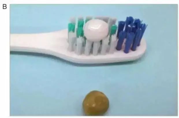 天天刷牙怎么还得龋齿,小孩天天刷牙怎么会蛀牙啊