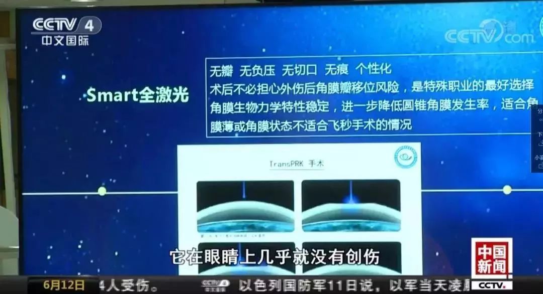彻底告别近视眼黑科技,怎么治疗近视眼不用戴眼镜