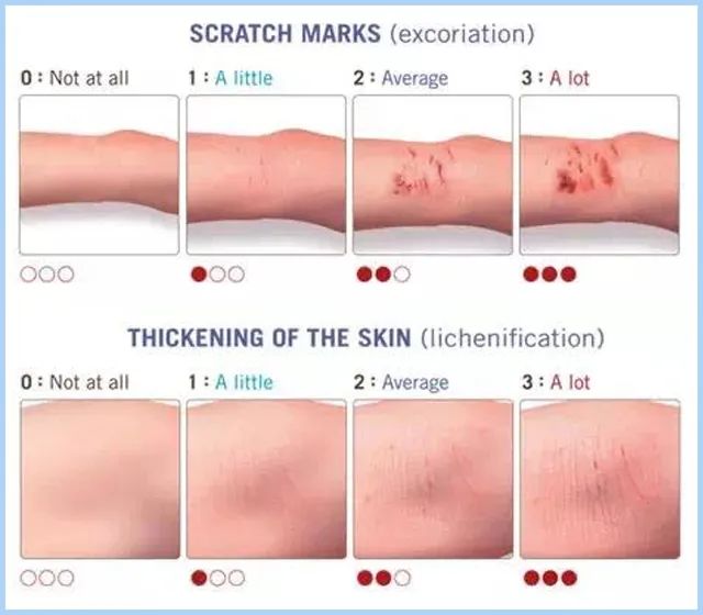 怎么改掉越长越丑的坏习惯,越来越丑的小习惯