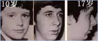 怎么改掉越长越丑的坏习惯,越来越丑的小习惯