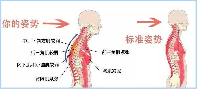 怎么改掉越长越丑的坏习惯,越来越丑的小习惯