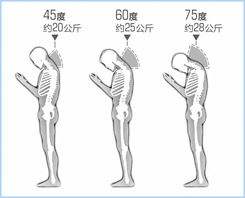 怎么改掉越长越丑的坏习惯,越来越丑的小习惯