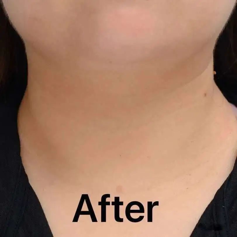 双十一值得回购的单品,双十一清单这些单品巨划算