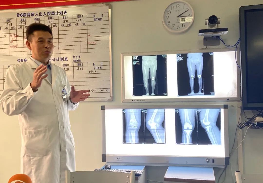 华西膝关节置换,华西医院人工关节置换