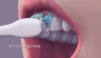 天天刷牙怎么还得龋齿,小孩天天刷牙怎么会蛀牙啊