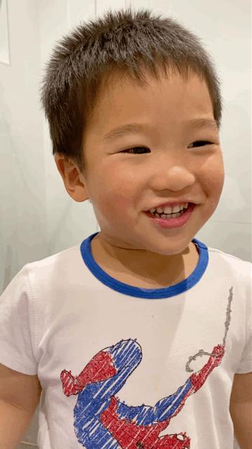 天天刷牙怎么还得龋齿,小孩天天刷牙怎么会蛀牙啊