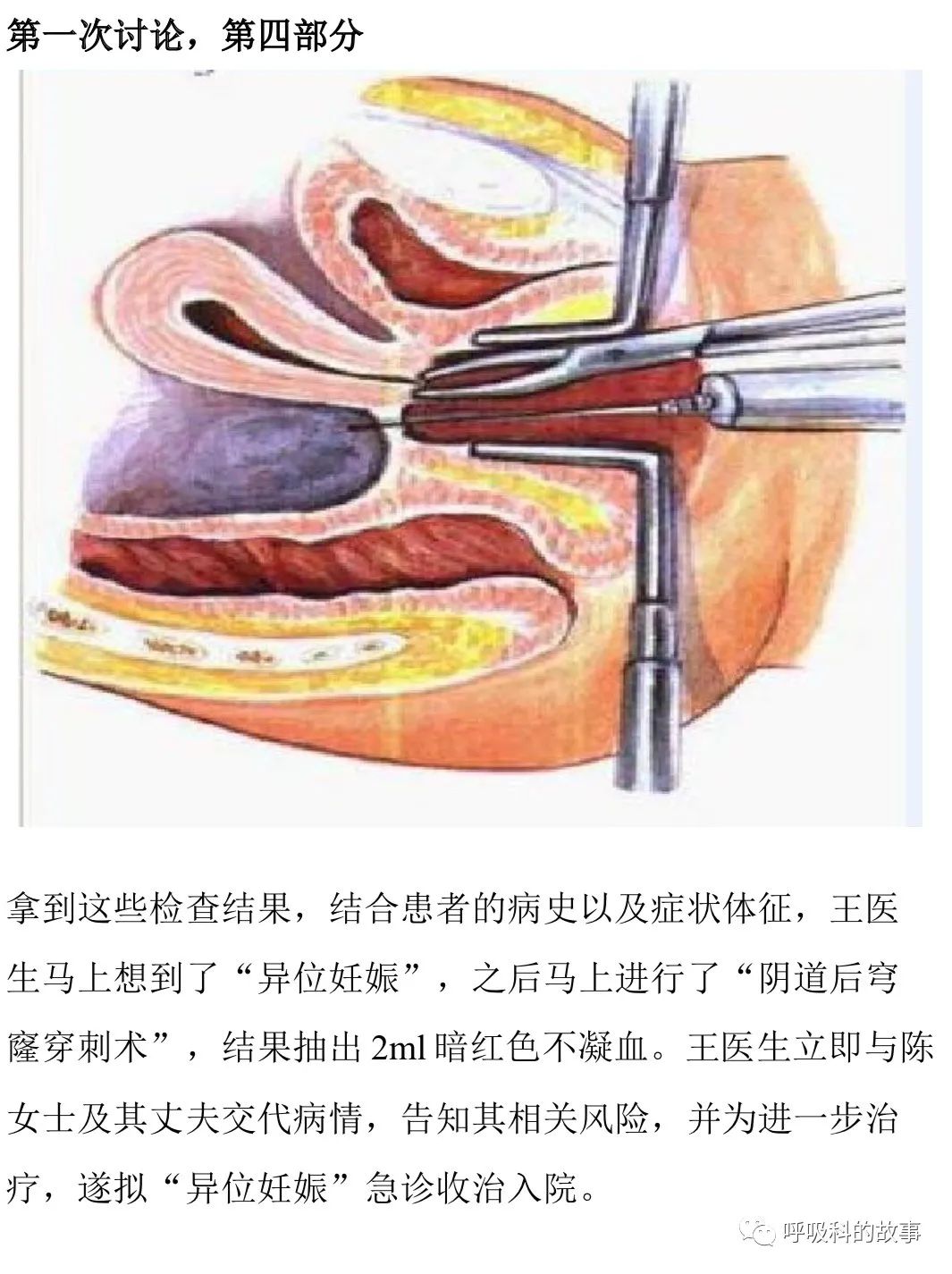 不一样的“月经”,不一样的PBL课
