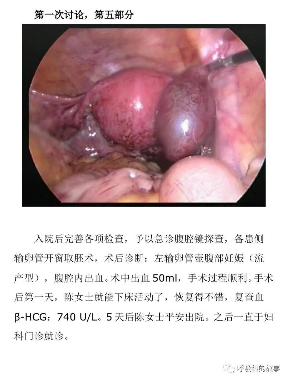 不一样的“月经”,不一样的PBL课