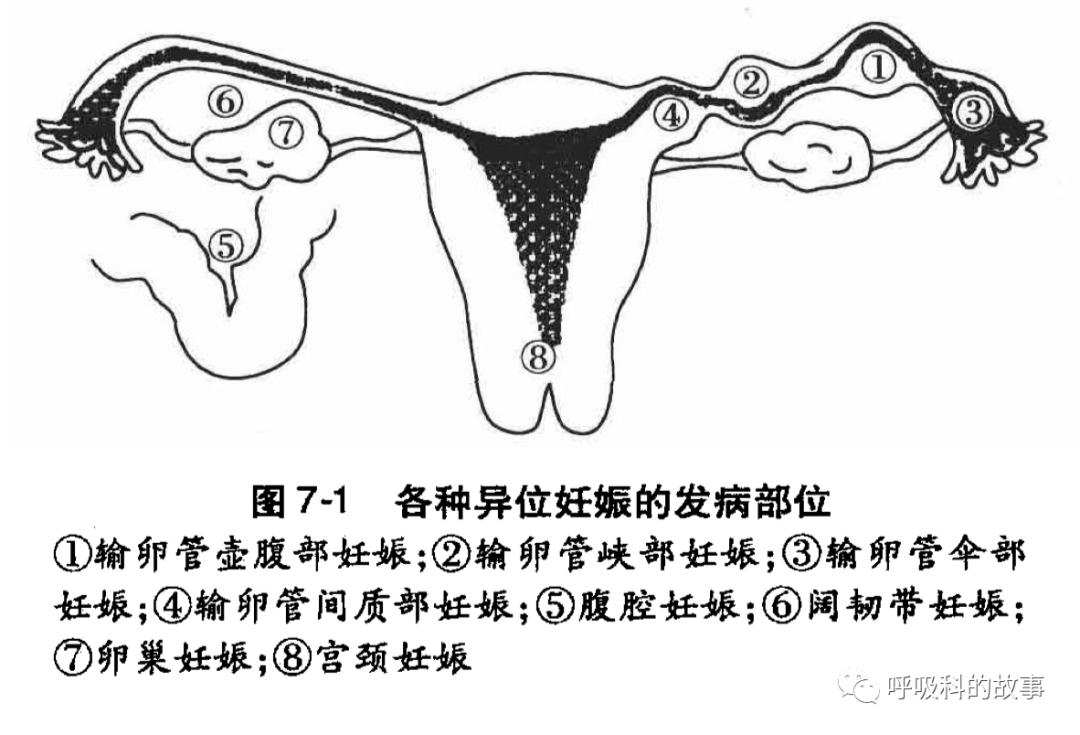 不一样的“月经”,不一样的PBL课