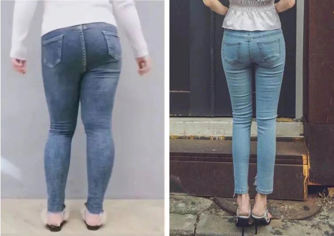 日本变态“腿部抽脂术”,7天小腿瘦3cm,堪比瘦腿针