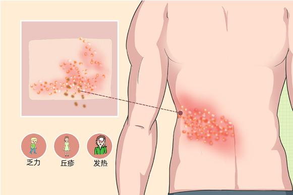 安阳市首批！接种开始