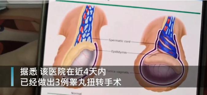 摔了一跤睾丸会扭转吗,摔了一跤睾丸出血