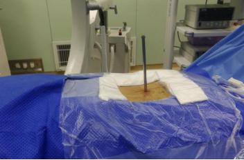 烟台业达医院用一根“小圆管”解决大问题