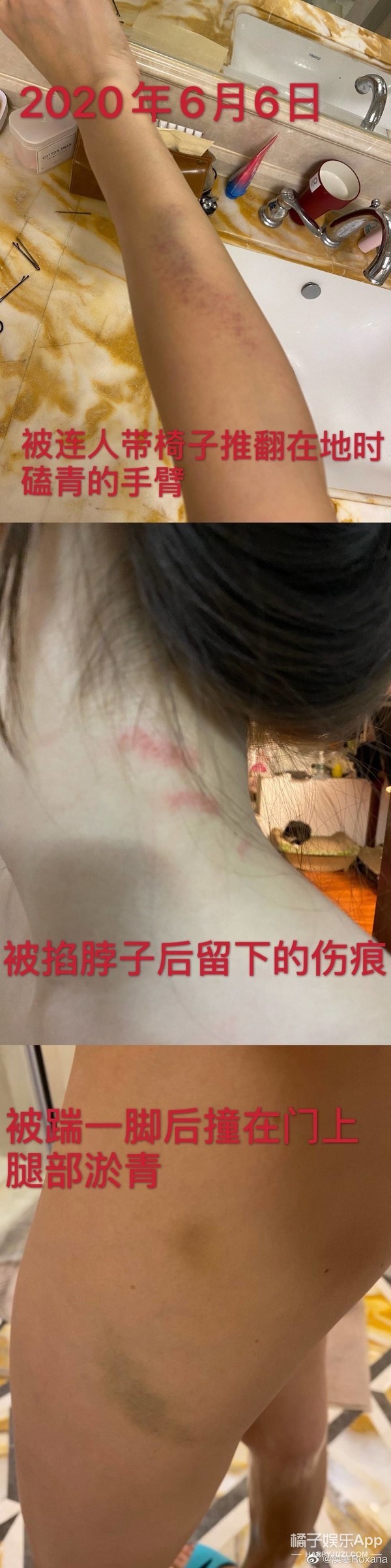 张培萌回应家暴妻子夫妻打架,张培萌妻子谈被家暴