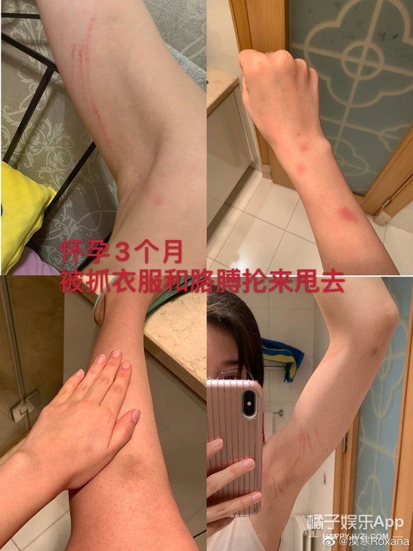 张培萌回应家暴妻子夫妻打架,张培萌妻子谈被家暴
