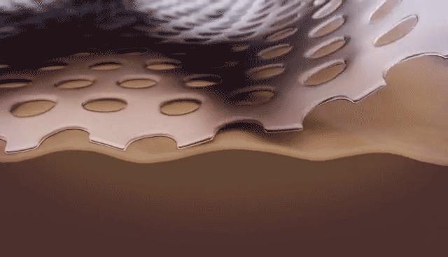 淡化疤痕原来淡疤可以这样做,每天用它擦一擦轻轻松松去除疤痕