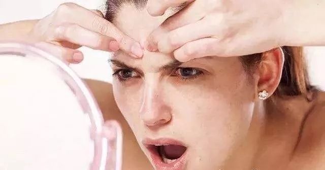 痘痘闭口挤出来的是什么,闭口痘痘挤出来白色物质