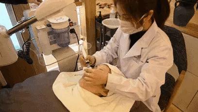 痘痘闭口挤出来的是什么,闭口痘痘挤出来白色物质