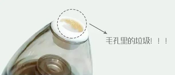 痘痘闭口挤出来的是什么,闭口痘痘挤出来白色物质