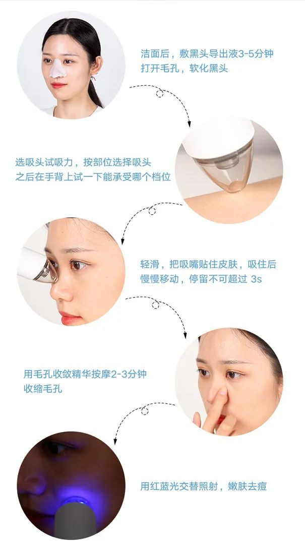 痘痘闭口挤出来的是什么,闭口痘痘挤出来白色物质