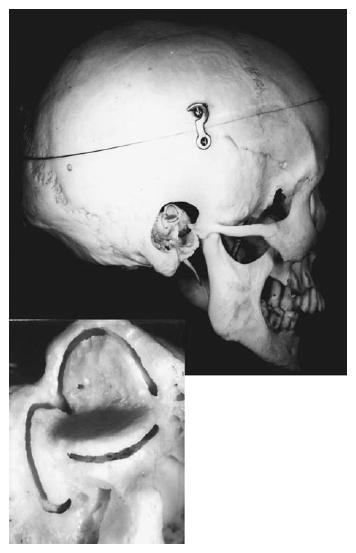 前庭眩晕康复科普,前庭康复训练方法和步骤